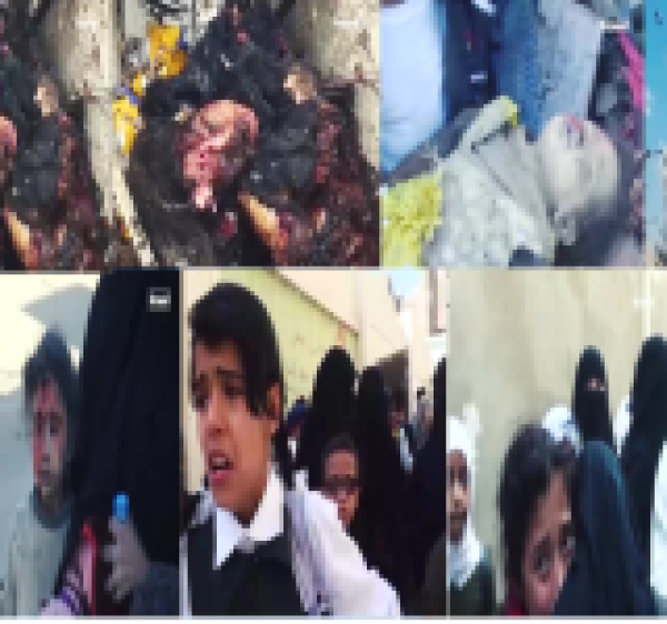 استشهاد أكثر من 15 ألف طفل وامرأة بالعدوان السعودي استشهاد أكثر من 15 ألف طفل وامرأة بالعدوان السعودي