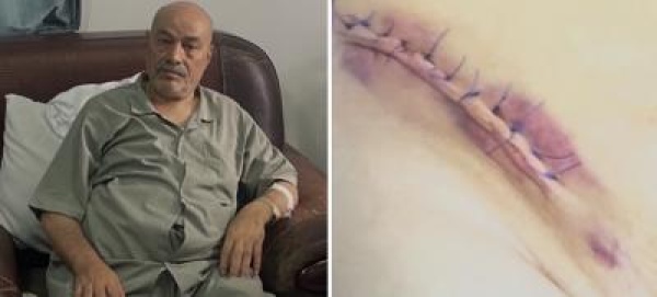 جريمة في رداء طب ي الشيخ يحيى الحباري يكشف تفاصيل محاولة اغتياله