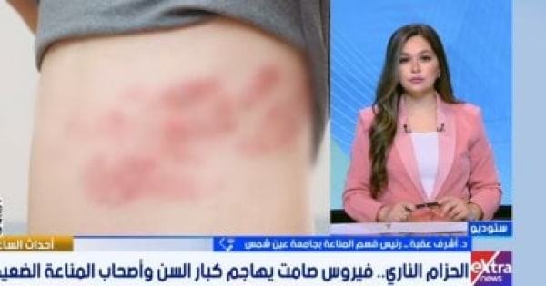 احذر الحزام الناري طبيب يوضح الأعراض والفئات الأكثر عرضة فيديو احذر الحزام الناري طبيب يوضح الأعراض والفئات الأكثر عرضة فيديو