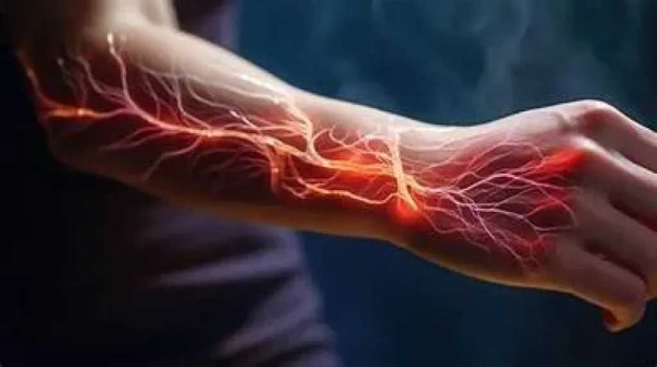 ضعف الأعصاب الأسباب والأعراض وأهم الفحوصات اللازمة للتشخيص