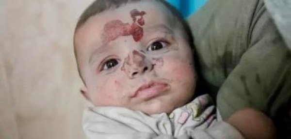 تصفية وجودية للأجيال إسرائيل أعدمت 20 ألف طفل فلسطيني تصفية وجودية للأجيال إسرائيل أعدمت 20 ألف طفل فلسطيني