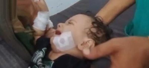 جرحى مدنيون بقصف للمرتزقة في التعزية جرحى مدنيون بقصف للمرتزقة في التعزية