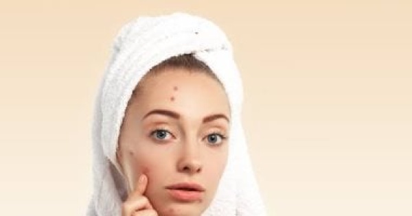 8 وصفات طبيعية لعلاج أشهر مشاكل البشرة من الهالات لحب الشباب 8 وصفات طبيعية لعلاج أشهر مشاكل البشرة من الهالات لحب الشباب