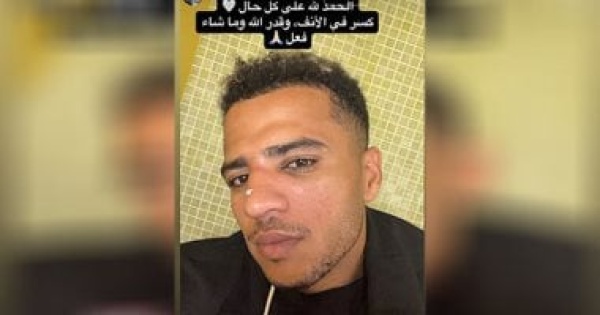 أحمد ربيع يعلن إصابته بكسر فى الأنف بعد مباراة الزمالك والجيش الرواندي