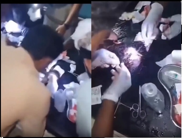 حيوان متوحش ينهش 12 يمنيا حيوان متوحش ينهش 12 يمنيا