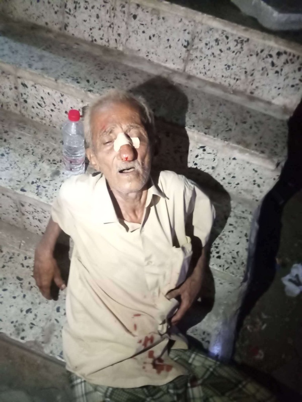 انهيار مواطن في أحد شوارع عدن بسبب موجة الحر الشديد انهيار مواطن في أحد شوارع عدن بسبب موجة الحر الشديد