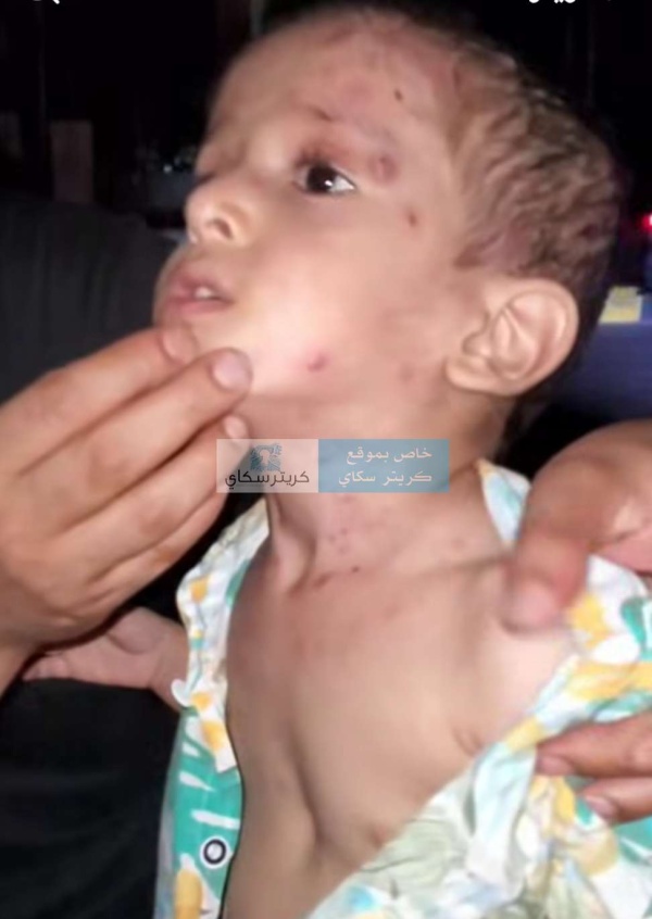 صورة موجعة تكشف جانب ا خفي ا من معاناة أبناء عدن مع الكهرباء صورة موجعة تكشف جانب ا خفي ا من معاناة أبناء عدن مع الكهرباء