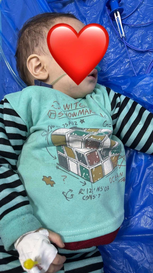 إنقاذ طفلة ابتلعت قطعة معدنية في إب إنقاذ طفلة ابتلعت قطعة معدنية في إب