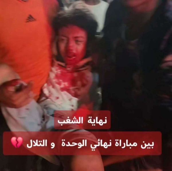 أحداث مؤسفة تعكر كلاسيكو عدن إصابات بين الجماهير ومطالبات بمحاسبة المسؤولين أحداث مؤسفة تعكر كلاسيكو عدن إصابات بين الجماهير ومطالبات بمحاسبة المسؤولين