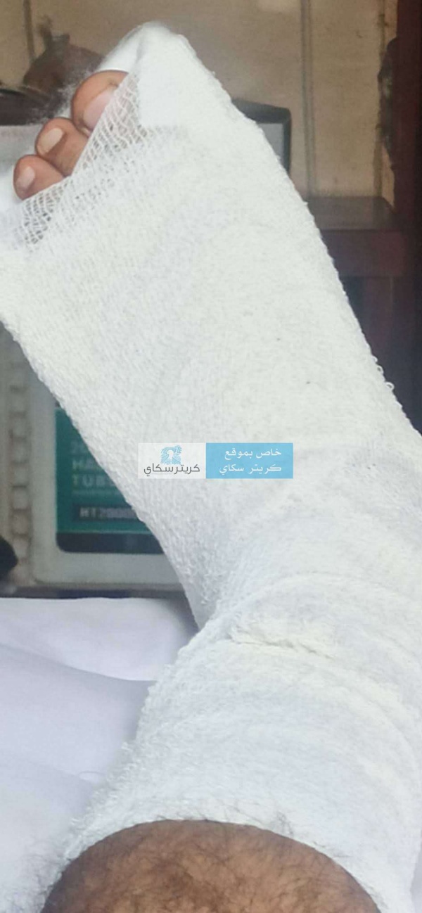 كلاب ضالة تقتحم منزلا وتتسبب بكسر مواطن في عدن ومناشدة عاجلة للمحافظ