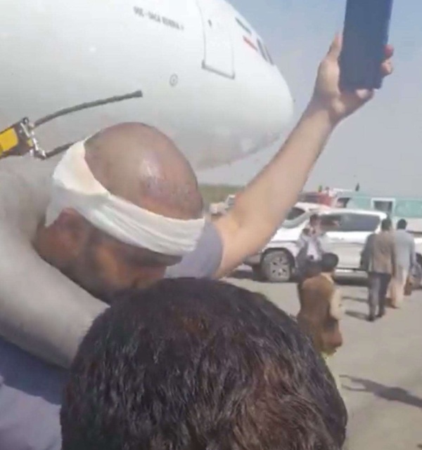 ذهب لتشييع المرشد قيادي حو ثي يعود من طهران بـ شعر جديد ذهب لتشييع المرشد قيادي حو ثي يعود من طهران بـ شعر جديد