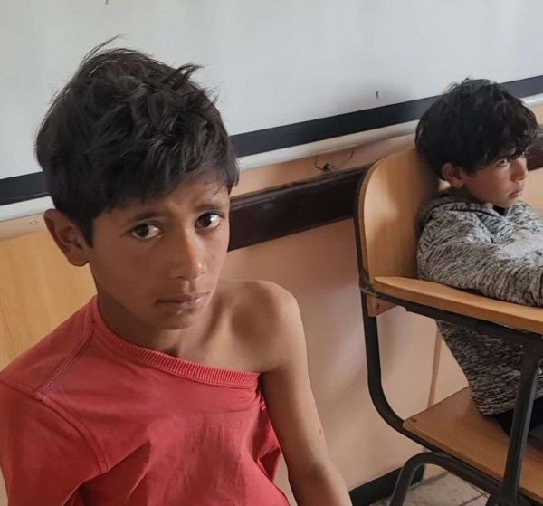إصابات جديدة بعضات كلاب خلال يوم واحد بتعز