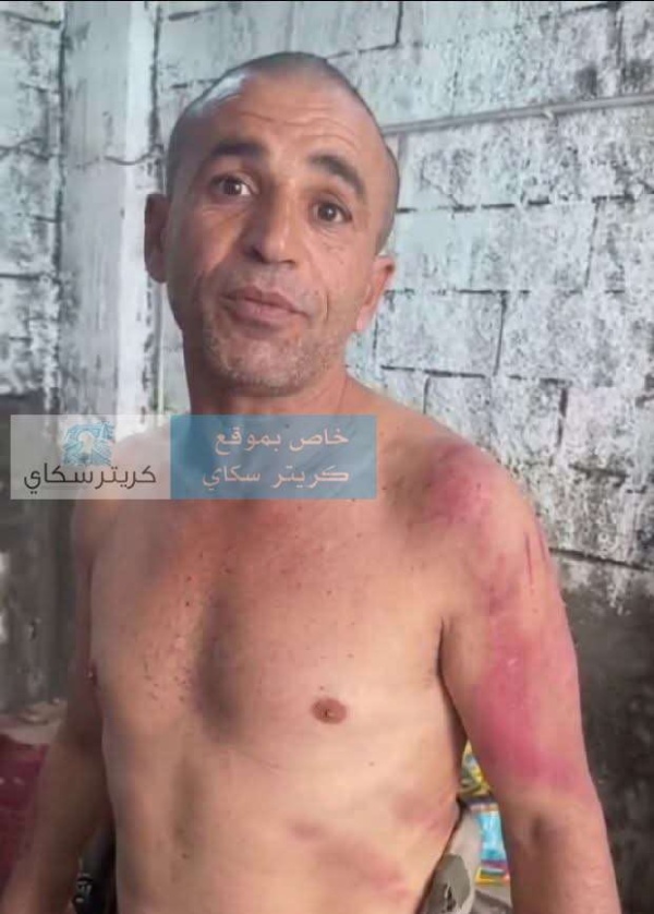 مواطن يروي تعرضه للاعتداء ويطالب بفتح تحقيق مواطن يروي تعرضه للاعتداء ويطالب بفتح تحقيق