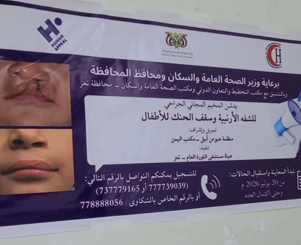 مستشفى الثورة بتعز يطلق مخيم ا طبي ا مجاني ا لعلاج الشفة الأرنبية وشق سقف الحنك للأطفال مستشفى الثورة بتعز يطلق مخيم ا طبي ا مجاني ا لعلاج الشفة الأرنبية وشق سقف الحنك للأطفال