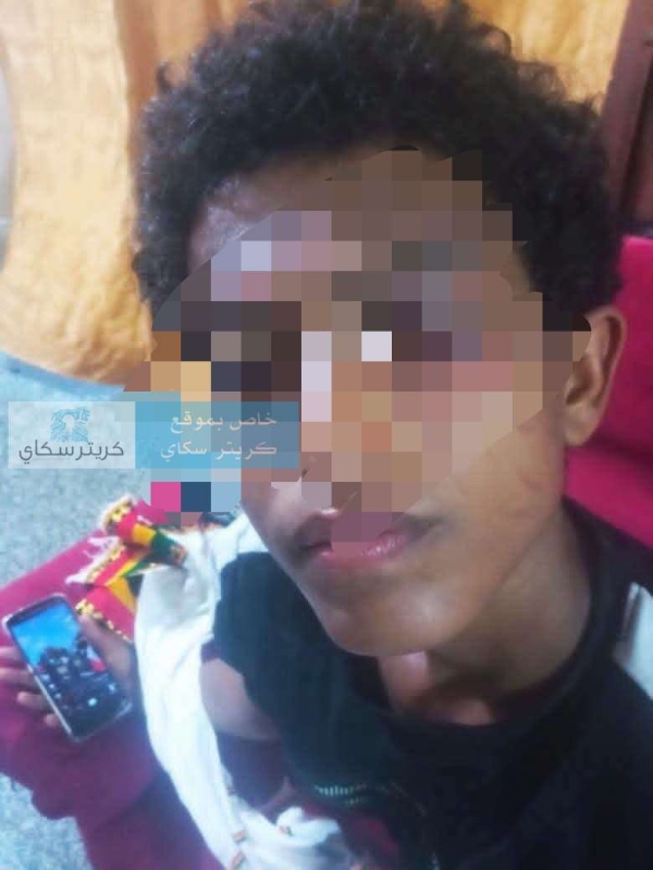 ذهب لصلاة الفجر فعاد بعين مصابة اعتداء على طفل داخل مسجد في عدن يثير الغضب ذهب لصلاة الفجر فعاد بعين مصابة اعتداء على طفل داخل مسجد في عدن يثير الغضب
