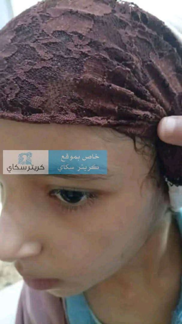 جر يمة مروعة تعرض طفلة لتعذيب قاس على يد زوجة أبيها