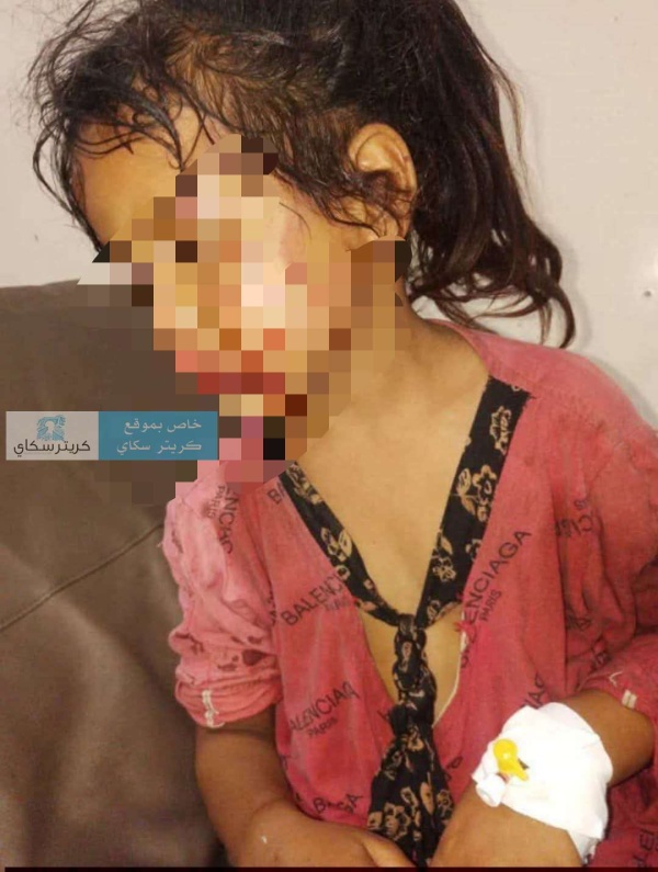 كلب يفترس براءة طفلة والأهالي يطالبون بتحرك فوري