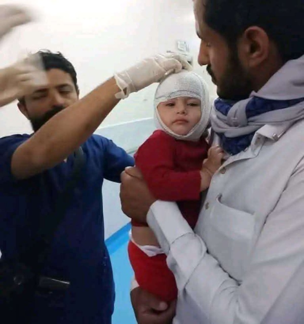 بالصورة إصابة طفل بقصف حو ثي على مأرب