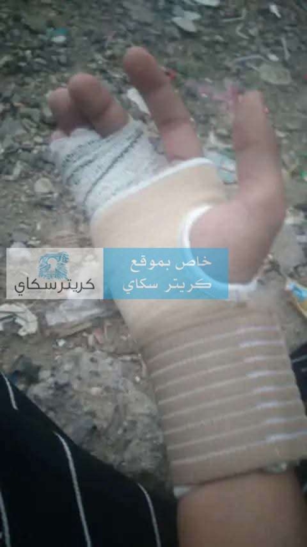 اتهامات صادمة لمدير مدرسة بضرب طلاب بسلك كهربائي وكسر يد أحدهم اتهامات صادمة لمدير مدرسة بضرب طلاب بسلك كهربائي وكسر يد أحدهم