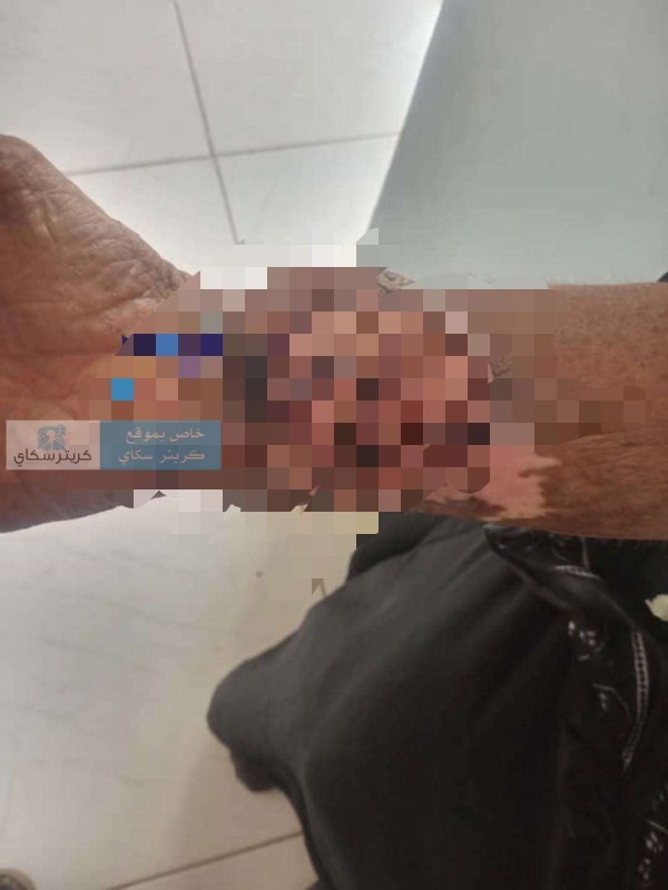 ورم خبيث يهدد حياة أرملة 400 ألف ريال تفصلها عن العملية