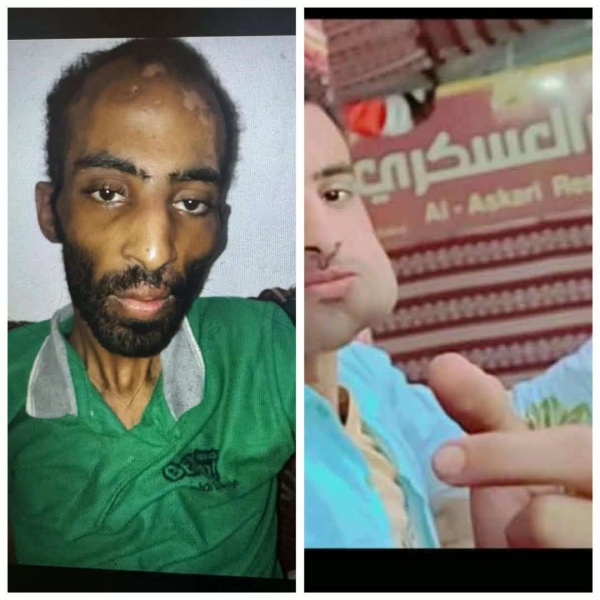 قضية الشاب ماجد تهز الشارع خطف وتعذيب أم حادث مروري قضية الشاب ماجد تهز الشارع خطف وتعذيب أم حادث مروري
