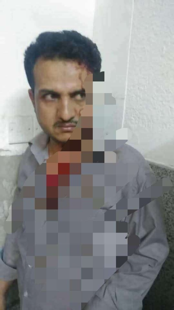 عاجل اعتداء على طبيب في مستشفى الثورة بصنعاء لعدم مشاركته في احتفال المولد النبوي
