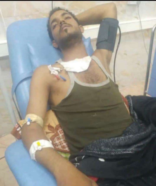 وفاة شاب متأثرا بإصابته خلال القتال مع الحوثيين