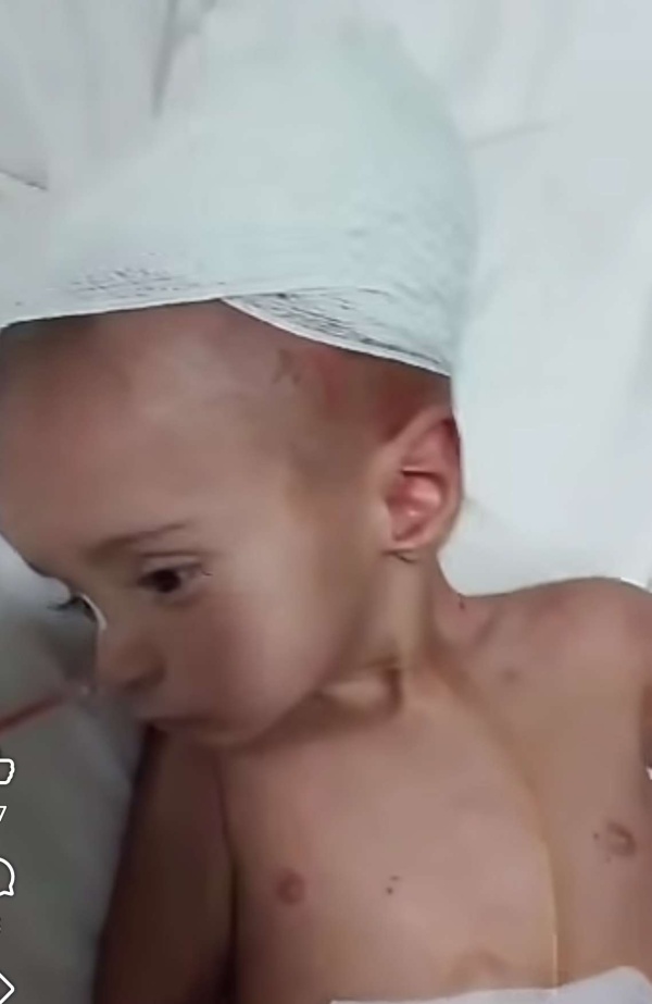 أب من تعز يصرخ لإنقاذ طفله في عدن عملية في الدماغ تنتهي بمضاعفات خطيرة واتهامات بخطأ طبي
