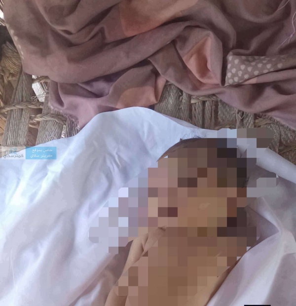 صورة تختصر المأساة طفلة من المضاربة ضحية للقصف الحو ثي