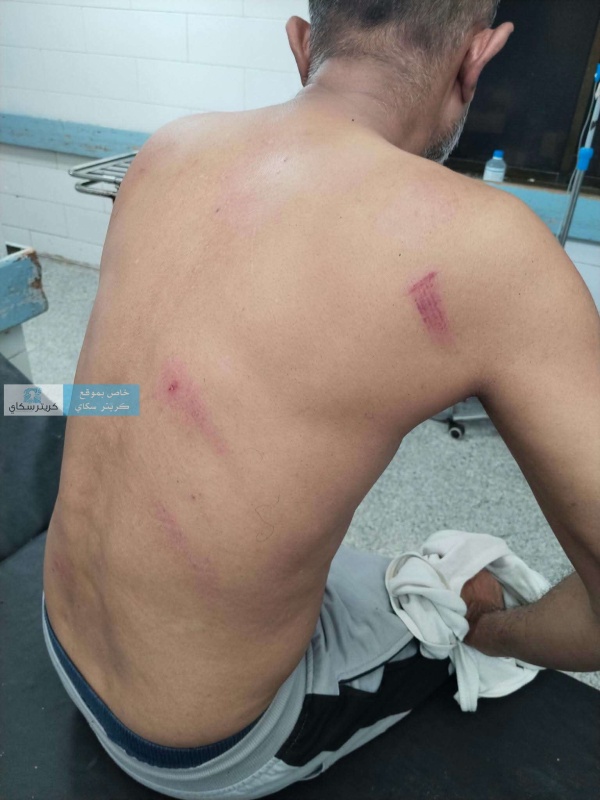 عاجل تعرض المحامي نزار سرارو للضرب والطعن واتهام لشرطة خورمكسر برفض ضبط المعتدين عاجل تعرض المحامي نزار سرارو للضرب والطعن واتهام لشرطة خورمكسر برفض ضبط المعتدين