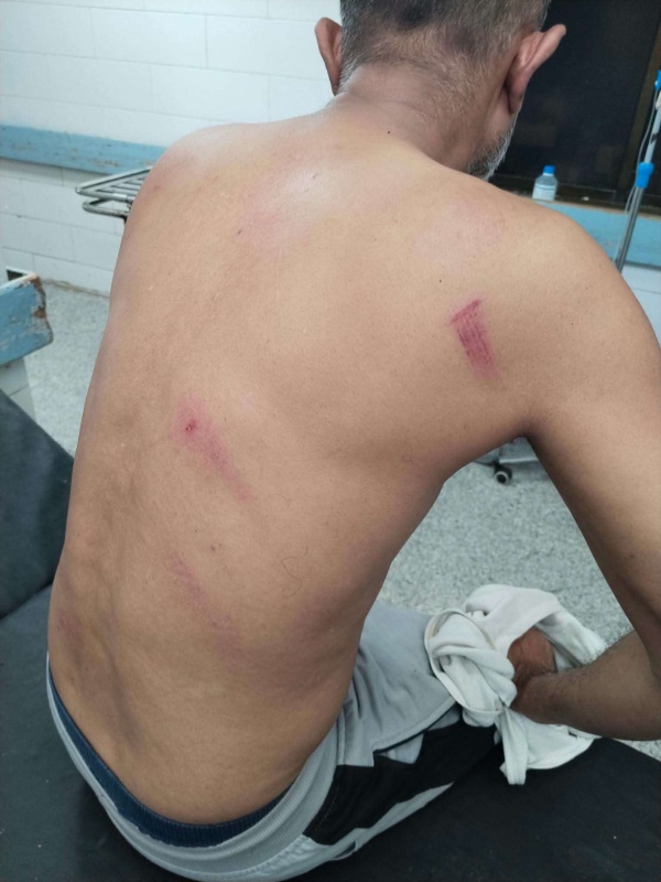 محام بعدن يحمل شرطة خورمكسر مسؤولية سلامته بعد تعرضه للطعن محام بعدن يحمل شرطة خورمكسر مسؤولية سلامته بعد تعرضه للطعن