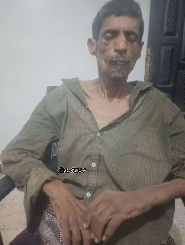 عاجل شرطة كابوتا تعثر على شخص بحالة صحية متعبة في عدن وتنقله إلى المستشفى عاجل شرطة كابوتا تعثر على شخص بحالة صحية متعبة في عدن وتنقله إلى المستشفى