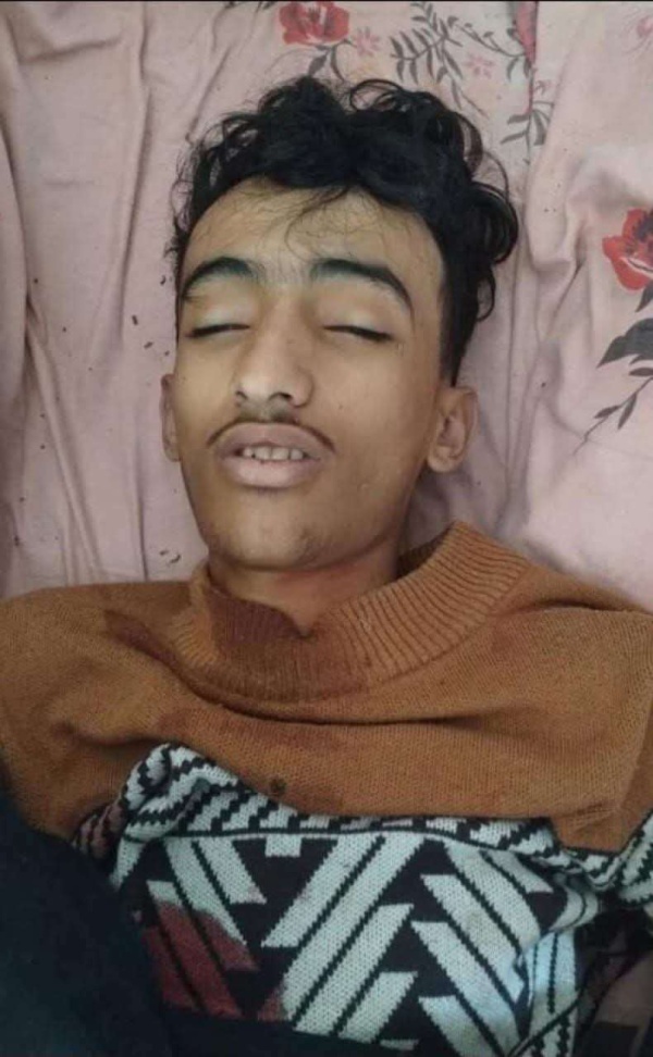 جريمة مرو عة الحو ثيين يقتلون الطفل عمار ياسر الشريحي في تعز والسبب صادم جريمة مرو عة الحو ثيين يقتلون الطفل عمار ياسر الشريحي في تعز والسبب صادم
