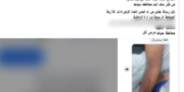 كشف ملابسات تضرر سيدة من تعدي طالب على نجلها بالضرب باستخدام سلاح أبيض وتهديدها كشف ملابسات تضرر سيدة من تعدي طالب على نجلها بالضرب باستخدام سلاح أبيض وتهديدها