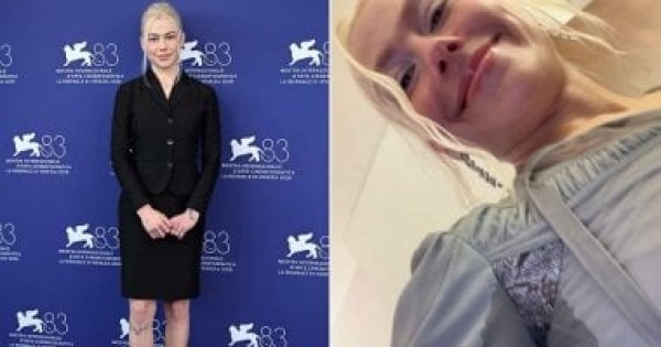بعد إطلالة فيبى بريدجرز المثيرة للجدل هل تتغير نظرة النساء لإزالة الشعر