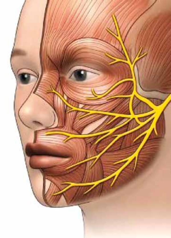 أسباب وأعراض العصب السابع وطرق الوقاية منه