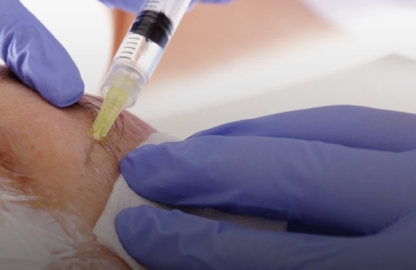 عاجل حظر محاقن التجميل ومهلة حتى 2026 لسحب المنتجات المخالفة
