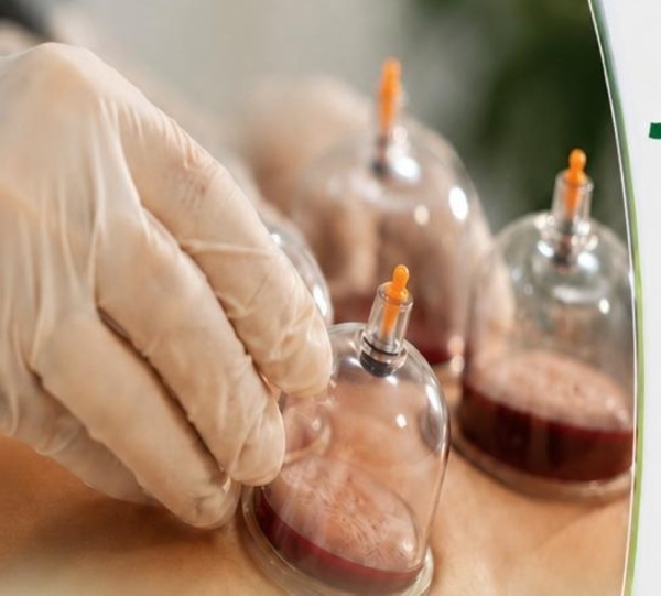 الوطني للطب البديل الأدلة العلمية على الحجامة والوخز بالإبر لعلاج الصدفية ما تزال محدودة الوطني للطب البديل الأدلة العلمية على الحجامة والوخز بالإبر لعلاج الصدفية ما تزال محدودة