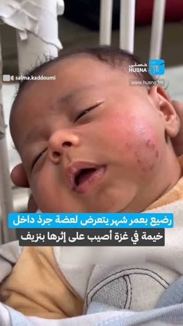 أبو سليمة مليون ونصف نازح في غزة يواجهون ظروف ا إنسانية وصحية قاسية