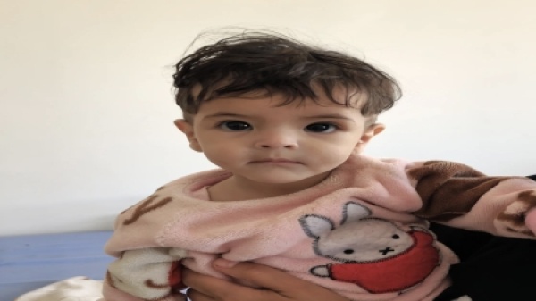 اليمن إصابة أكثر من 5 آلاف طفل بسوء التغذية في البيضاء خلال خمسة أشهر اليمن إصابة أكثر من 5 آلاف طفل بسوء التغذية في البيضاء خلال خمسة أشهر
