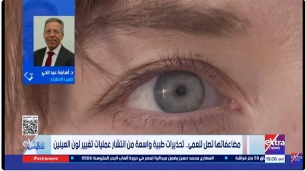 نقيب الأطباء تغيير لون العين تجميلي ويهدد بفقدان البصر