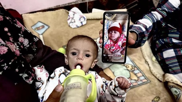 يوم الأغذية العالمي كارثة غذائية تهدد نحو نصف سكان قطاع غزة يوم الأغذية العالمي كارثة غذائية تهدد نحو نصف سكان قطاع غزة