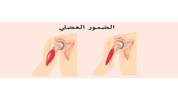 اختراق علمي روسي يمهد الطريق لابتكار اول دواء في العالم لعلاج ضمور العضلات