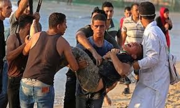 إصابة أربعة فلسطينيين جراء اعتداءات المستوطنين في مسافر يطا إصابة أربعة فلسطينيين جراء اعتداءات المستوطنين في مسافر يطا