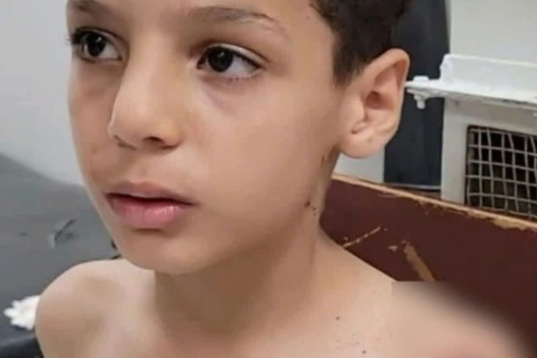 إصابة طفل 10 أعوام بشظية في تعز جراء قصف حوثي على حي سكني