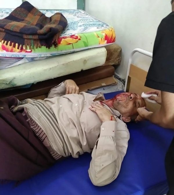 مليشيات الحوثي تقصف مدنيين على خط مريس دمت وتصيب أكثر من ثلاثة أشخاص