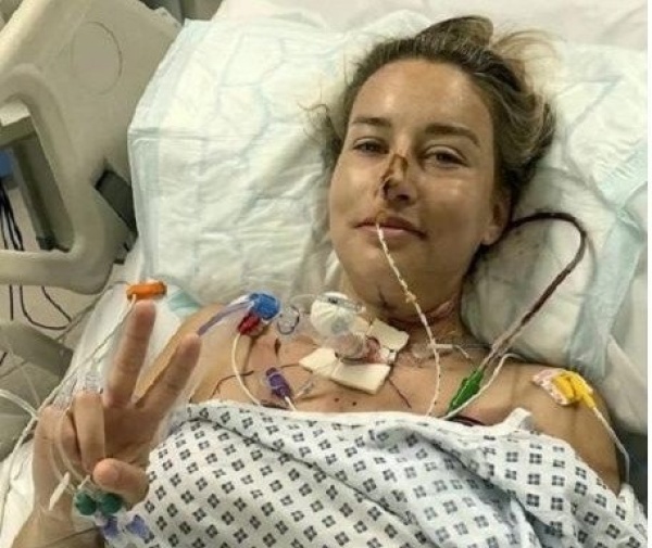 في عملية استغرقت 13 ساعة أطباء يعيدون بناء لسان بريطانية مصابة بالسرطان بجزء من ساقها