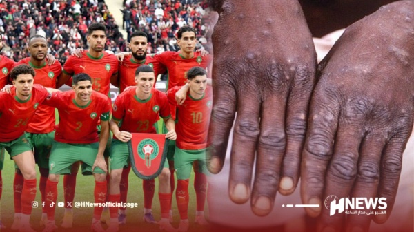 جدري القردة يربك حسابات الأسود قبل رحلة جنوب إفريقيا لمواجهة ليسوتو جدري القردة يربك حسابات الأسود قبل رحلة جنوب إفريقيا لمواجهة ليسوتو