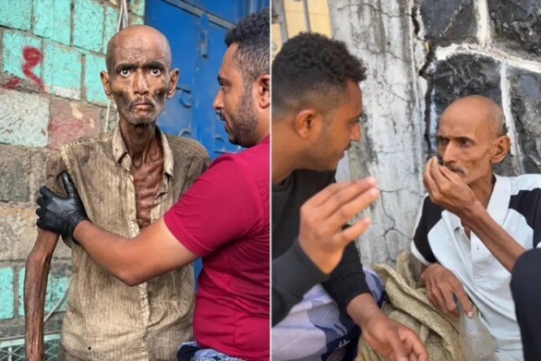 ليس طبيب ا مصري ا الكشف عن هوية المشرد الذي أثار الجدل في اليمن ومصر