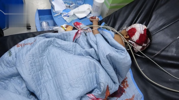 إصابة طفلة برصاص قناص تابع لمرتزقة العدوان في الضالع
